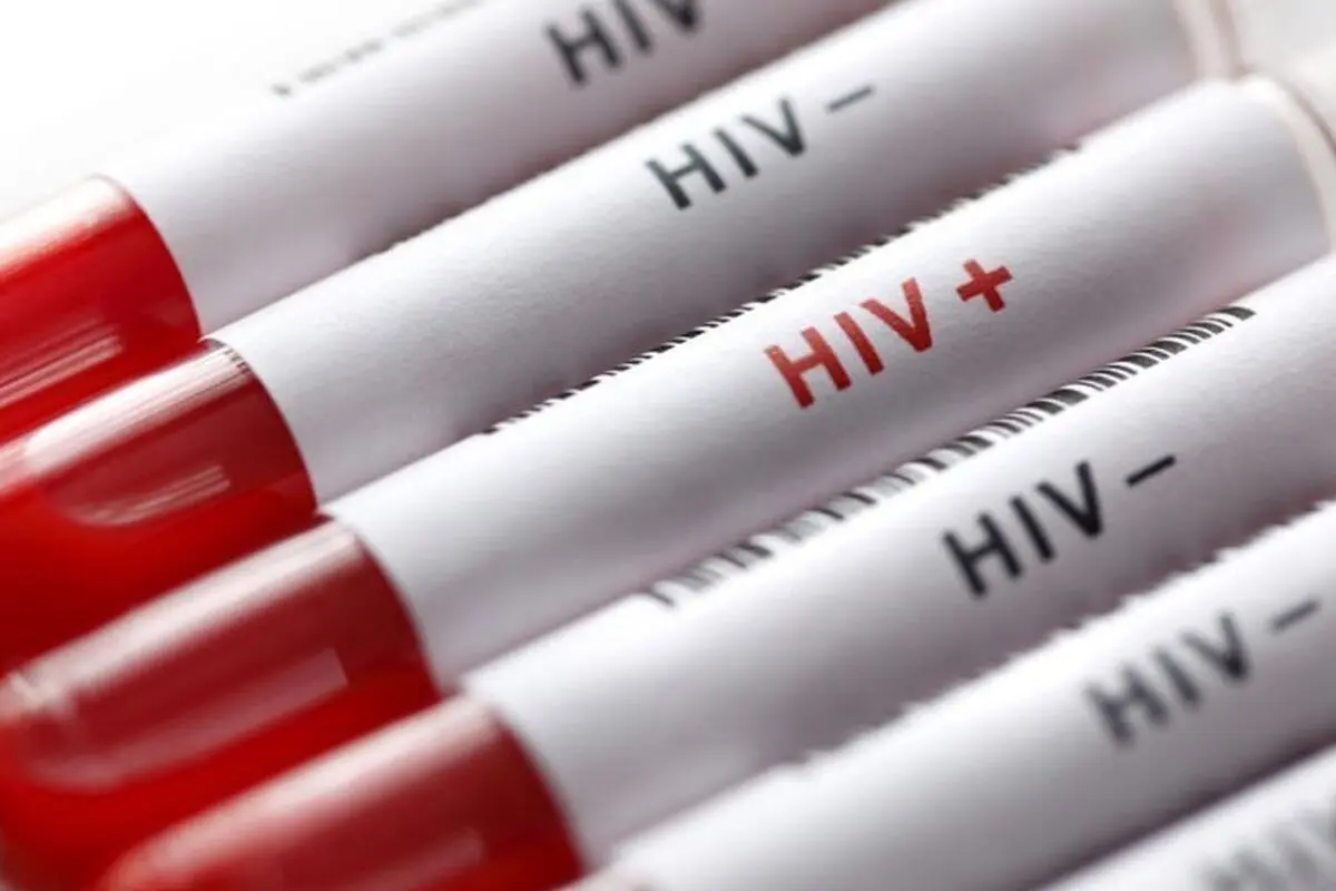 افشای اطلاعات محرمانه بیماران HIV