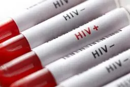 افشای اطلاعات محرمانه بیماران HIV