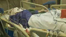 ضربه مغزی دانش‌آموز ۱۴ ساله پس از تصادف