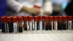 شهرواندان استان هرمزگان برای انتقال خون مراجعه کنند + آدرس مراکز انتقال خون 