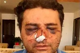 بمب ساعتی ابدی