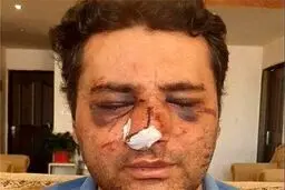 بمب ساعتی ابدی