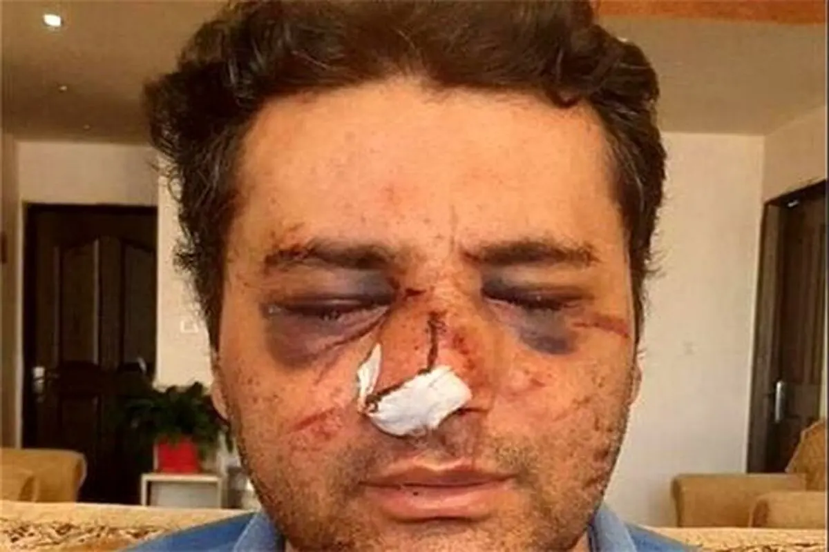 بمب ساعتی ابدی