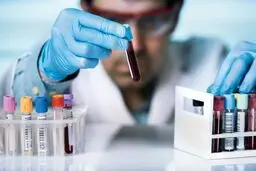 بهترین دمنوش معجزه‌آسا برای کنترل چربی خون
