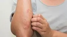 ۴ عادت ناسالم برای نابودی سلامت پوست
