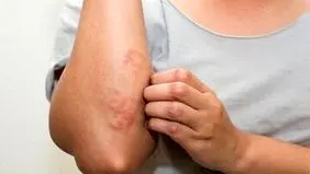 ۴ عادت ناسالم برای نابودی سلامت پوست