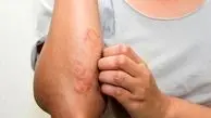 ۴ عادت ناسالم برای نابودی سلامت پوست