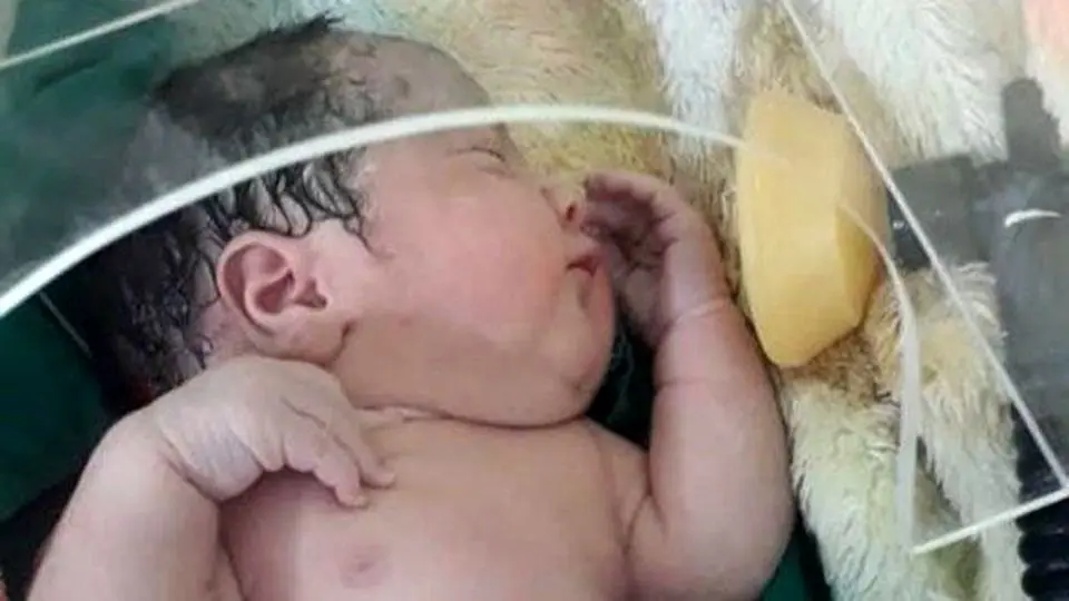 مرگ نوزاد تازه متولدشده با گاز CO۲ در مشهد