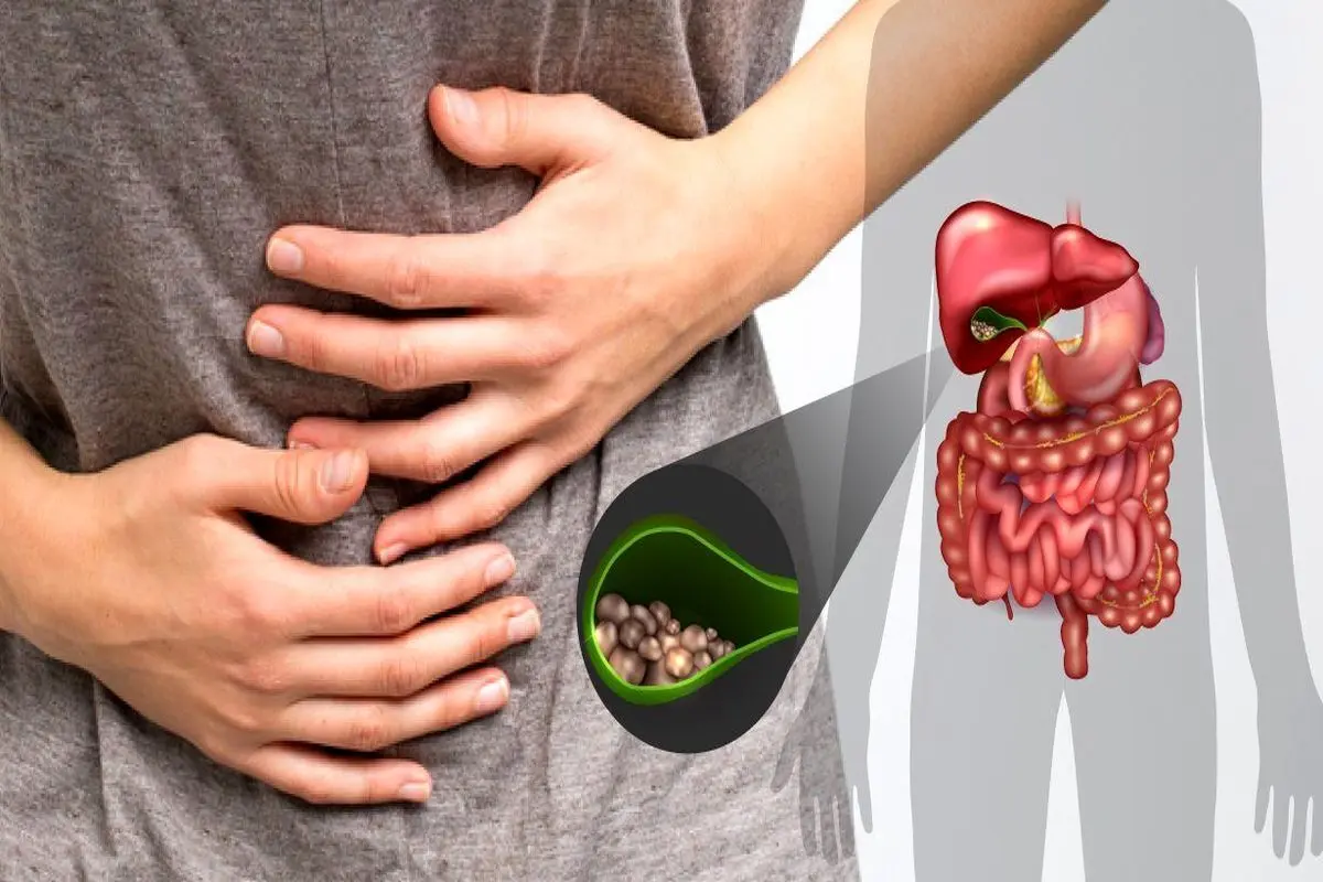 این غذاها برای کیسه صفرا ضرر دارد
