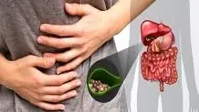 این غذاها برای کیسه صفرا ضرر دارد
