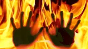 اقدام به خودسوزی مراجعه‌کننده به دادسرای کهنوج/ حال عمومی فرد مساعد است

