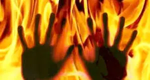 اقدام به خودسوزی مراجعه‌کننده به دادسرای کهنوج/ حال عمومی فرد مساعد است

