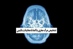 تشخیص مرگ مغزی یا کما با معاینات بالینی