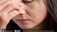 با خون دماغ گرمی‌ هوا چه کنیم 

