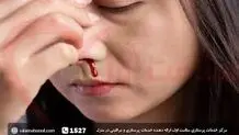 با خون دماغ گرمی‌ هوا چه کنیم 

