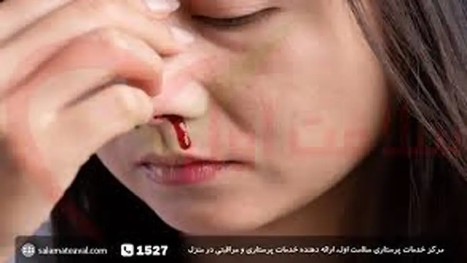 با خون دماغ گرمی هوا چه کنیم