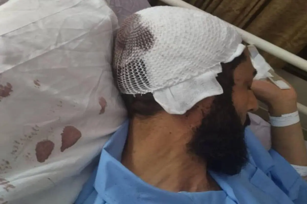 حمله به ۲ روحانی در قم با لوله آهنی