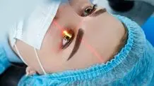 هزینه ۲۰۰  تا ۳۰۰ میلیونی عمل تغییر رنگ چشم در کشور