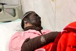 ۱۵ فوتی و ۵۴ قطع عضو ناشی از حوادث چهارشنبه‌سوری امسال در کشور