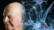 عوامل موثر  پیر کننده مغز