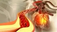 کاهش کلسترول با این ۵ خوراکی‌ ساده 