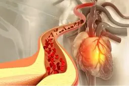 کاهش کلسترول با این ۵ خوراکی‌ ساده 