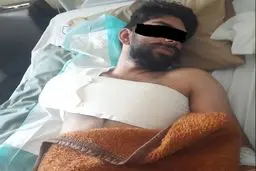 دست یک  کارگر بروجردی حین کار از بازو قطع شد / حقوق این کارگر فقط شش میلیون تومان بوده است!