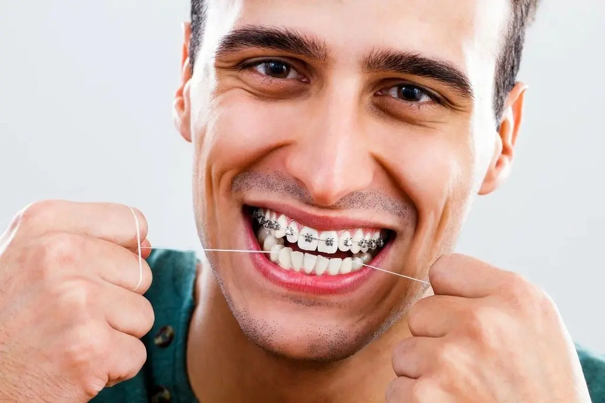 هزینه ارتودنسی دندان چقدر است؟