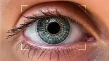 جراحی تغییر رنگ چشم خطرناک است + هشدارهای یک چشم پزشک 