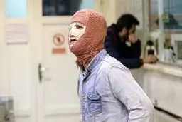 سوختگی درجه یک نوجوان ۱۳ ساله بر اثر انفجار ترقه