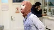 سوختگی درجه یک نوجوان ۱۳ ساله بر اثر انفجار ترقه
