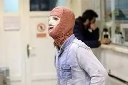 سوختگی درجه یک نوجوان ۱۳ ساله بر اثر انفجار ترقه