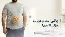 چاقی؛ بیماری مزمن یا ویژگی ظاهری؟