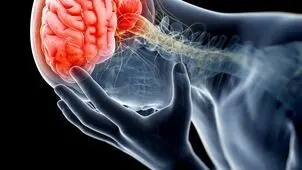 هشدار وزارت بهداشت درباره سکته مغزی؛ هر دقیقه تاخیر می‌تواند سرنوشت بیمار را تغییر دهد