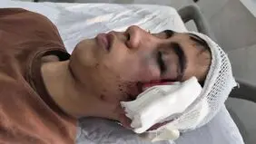 مصدومیت شدید دانش آموز بمی توسط معلمش+ عکس