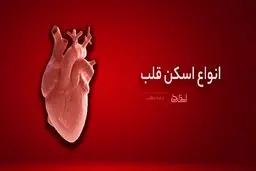 اطلاعاتی از اسکن قلب که باید حتما بدانید