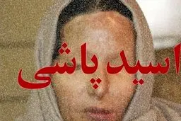 حکم باورنکردنی برای اسیدپاشی به همسر