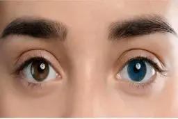 مشکلات بینایی و نابینایی از عوارض جراحی تغییر رنگ چشم است
