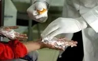 سازمان اورژانس: آمار مصدومان حوادث چهارشنبه‌سوری به ۸۸۱ نفر رسید