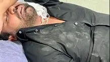 تصادف شدید میثم ابراهیمی خواننده پاپ+ عکس
