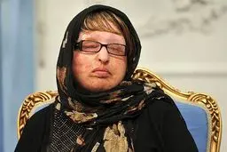 آمنه بهرامی: هنوز دیه چشمانم را نگرفته‌ام