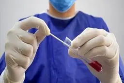 باحثون ایرانیون یصنعون جهازا لتشخیص الأمراض الفیروسیة في 20 ثانیة
