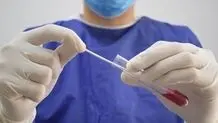 باحثون ایرانیون یصنعون جهازا لتشخیص الأمراض الفیروسیة في 20 ثانیة
