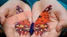 زخم‌های حلما زخم بی‌پناهی‌اند...

