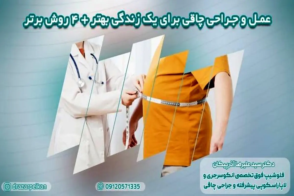 رهایی از چاقی: عمل و جراحی چاقی برای یک زندگی بهتر