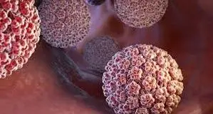 مراجعه دختران و پسران ۱۷  و ۱۸‌ساله با زگیل تناسلی