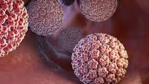 مراجعه دختران و پسران ۱۷  و ۱۸‌ساله با زگیل تناسلی