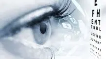 گردهمایی علمی چشم پزشکان ایران در تهران/ پزشکان مقاله بفرستند