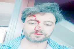 در سفارت افغانستان چه خبر است؟
