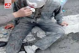 چند روش اورژانسی برای پیشگیری از خونریزی شدید در مجروحان جنگی